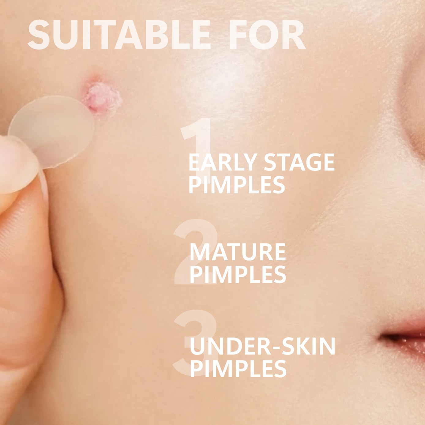Микроигольчатые патчи от прыще – обзор и цена Hydrocolloid Pimple Patch