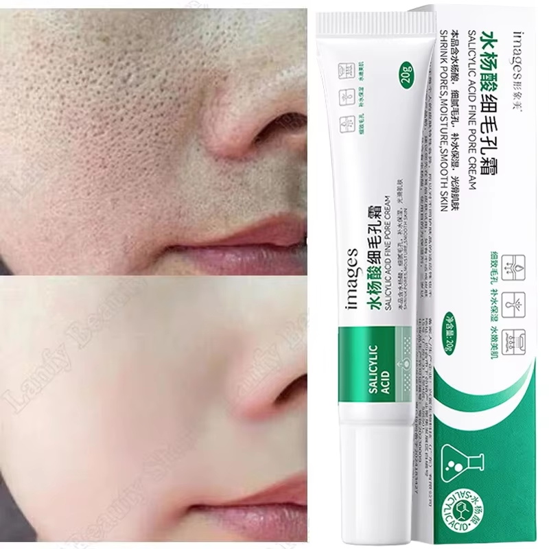 Крем с салициловой кислотой дл – обзор и цена Salicylic Acid Blackhead Remover